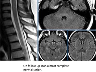 On follow up scan almost complete
normalisation.
 