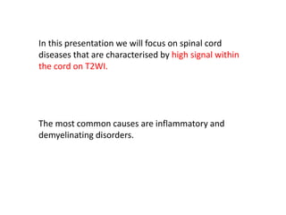 In this presentation we will focus on spinal cord
diseases that are characterised by high signal within
the cord on T2WI.
The most common causes are inflammatory and
demyelinating disorders.
 