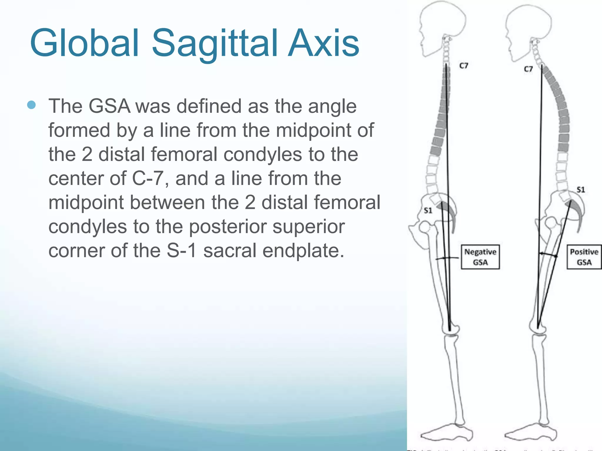 Evaluation of Spinal alignment | PPT