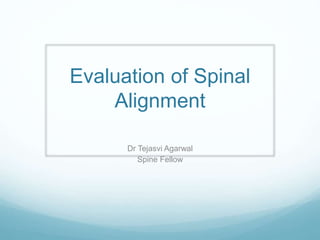 Evaluation of Spinal
Alignment
Dr Tejasvi Agarwal
Spine Fellow
 
