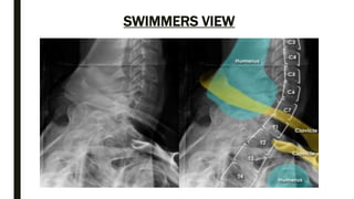 Twining Method Radiography Spine anatomy and xray of spine ppt by Dr Pratik | PPTX