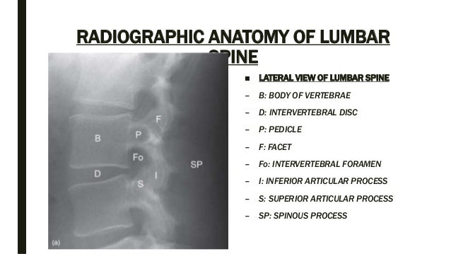 Spine anatomy and xray of spine ppt by Dr Pratik