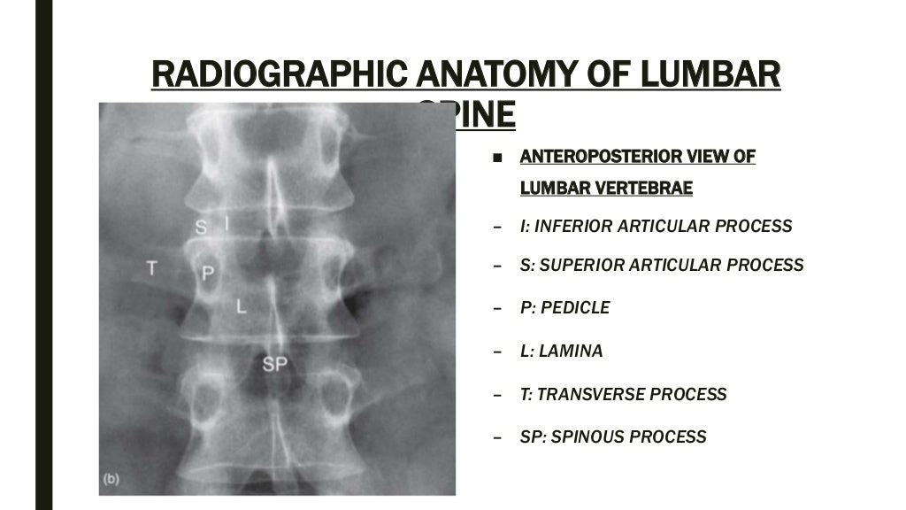 Spine anatomy and xray of spine ppt by Dr Pratik