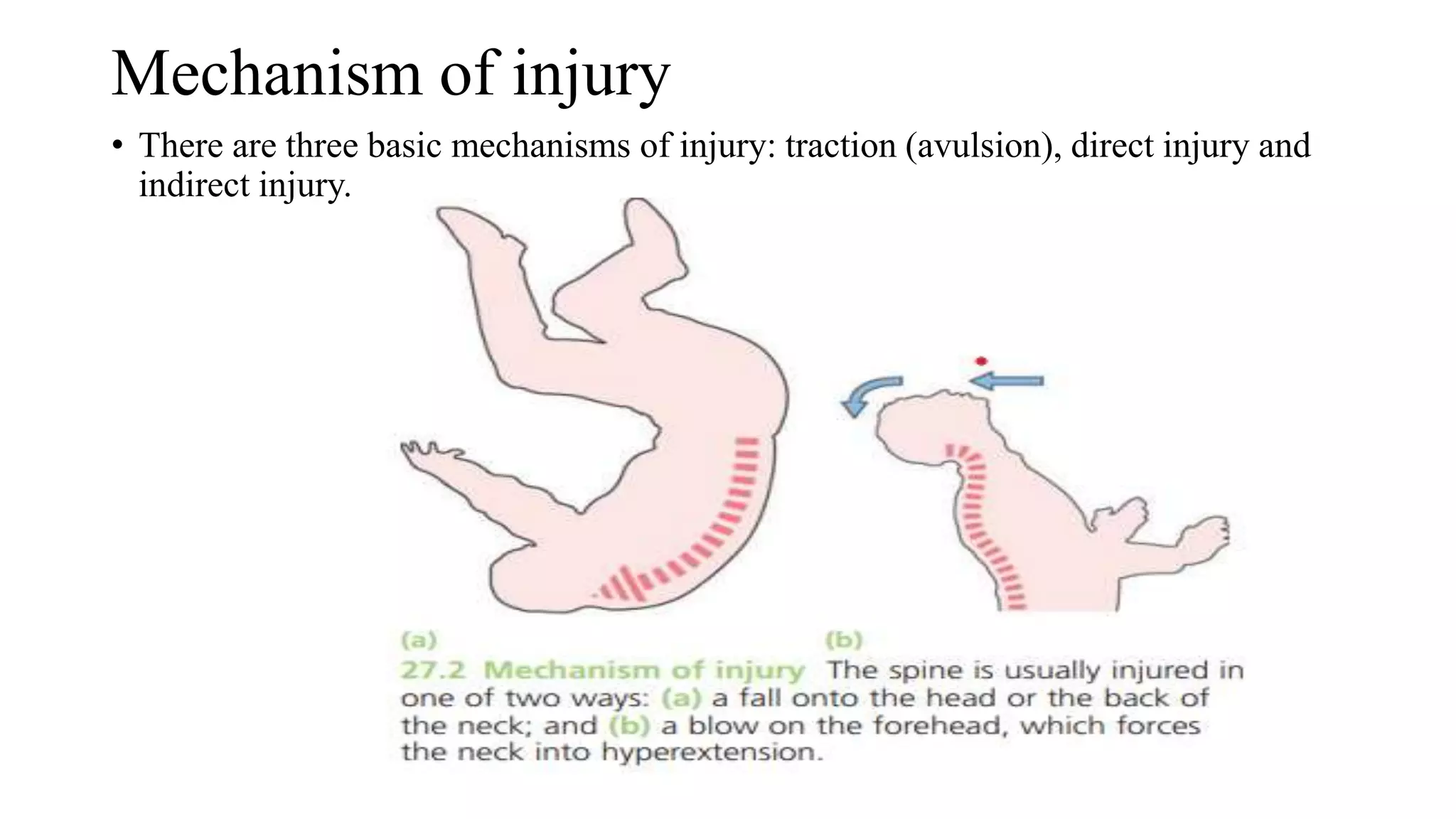 Extrinsic Injury Examples Spine and extermity injury.pptx
