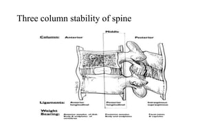 Three column stability of spine
 