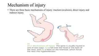 Mechanism of injury
• There are three basic mechanisms of injury: traction (avulsion), direct injury and
indirect injury.
 