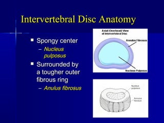 Intervertebral Disc AnatomyIntervertebral Disc Anatomy
 Spongy centerSpongy center
– NucleusNucleus
pulposuspulposus
 Surrounded bySurrounded by
a tougher outera tougher outer
fibrous ringfibrous ring
– Anulus fibrosusAnulus fibrosus
 