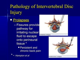Pathology of Intervertebral DiscPathology of Intervertebral Disc
InjuryInjury
 ProlapsesProlapses
– Fissures provideFissures provide
pathway forpathway for
irritating nuclearirritating nuclear
fluid to escapefluid to escape
onto perineuralonto perineural
tissue *tissue *
 Persistent andPersistent and
chronic back painchronic back pain
** -- Hampton et alHampton et al
 