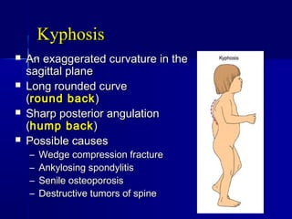 KyphosisKyphosis
 An exaggerated curvature in theAn exaggerated curvature in the
sagittal planesagittal plane
 Long rounded curveLong rounded curve
((round backround back))
 Sharp posterior angulationSharp posterior angulation
((hump backhump back))
 Possible causesPossible causes
– Wedge compression fractureWedge compression fracture
– Ankylosing spondylitisAnkylosing spondylitis
– Senile osteoporosisSenile osteoporosis
– Destructive tumors of spineDestructive tumors of spine
 