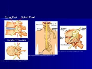 Lumbar Foramen
http://www.spineuniverse.com/displayarticle.php/article1973.html
http://www.spineuniverse.com/displayarticle.php/article1973.html
Spinal CordNerve Root
http://www.spineuniverse.com/displayarticle.php/article23.html
 
