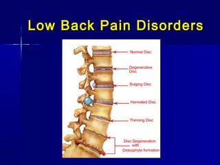 Low Back Pain DisordersLow Back Pain Disorders
 