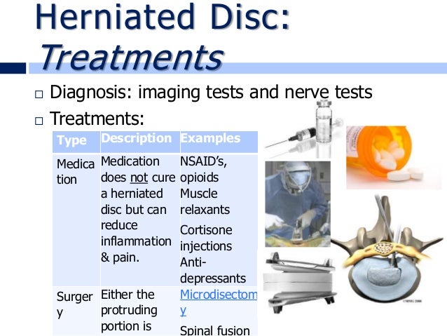 How do you treat a herniated disc?