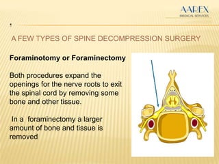 .
A FEW TYPES OF SPINE DECOMPRESSION SURGERY
Foraminotomy or Foraminectomy
Both procedures expand the
openings for the nerve roots to exit
the spinal cord by removing some
bone and other tissue.
In a foraminectomy a larger
amount of bone and tissue is
removed
 