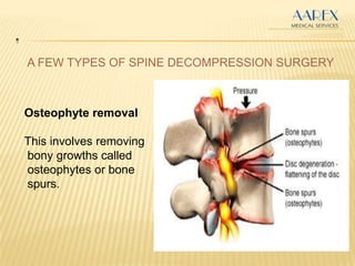 .
A FEW TYPES OF SPINE DECOMPRESSION SURGERY
Osteophyte removal
This involves removing
bony growths called
osteophytes or bone
spurs.
 
