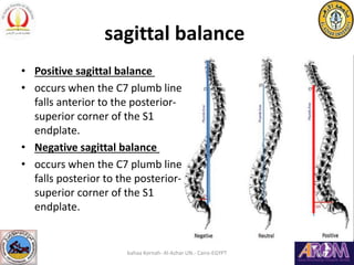 Spine deformities recognition and evaluation | PPT