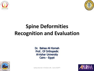 Spine Deformities
Recognition and Evaluation
Dr. Bahaa Ali Kornah
Prof.. Of Orthopedic
Al-Azhar University
Cairo - Egypt
bahaa Kornah- Al-Azhar UN.- Cairo-EGYPT
 