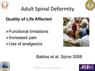 Adult Spinal Deformity
Quality of Life Affected
Functional limitations
Increased pain
Use of analgesics
Baldus et al. S...