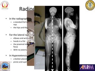 Radiographic Evaluation
• In the radiographic assessment we need
– a standard full-length (36-inch) posterior-anterior and...