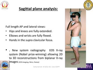 Sagittal plane analysis:
Full length AP and lateral views:
• Hips and knees are fully extended.
• Elbows and wrists are fu...