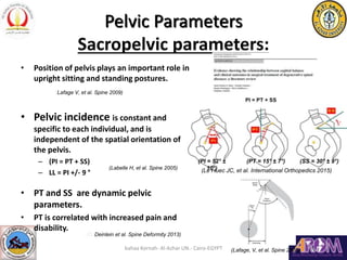 Pelvic Parameters
Sacropelvic parameters:
• Position of pelvis plays an important role in
upright sitting and standing pos...