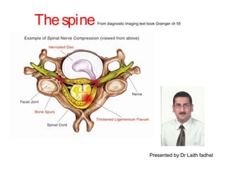 The spine From diagnostic imaging text book Grainger ch 55 
Presented by Dr Laith fadhel 
 