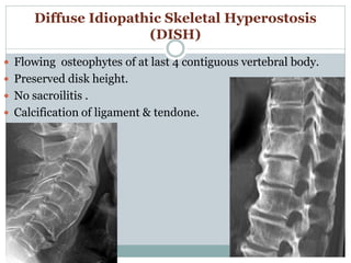 Spine disease in rg finding | PDF