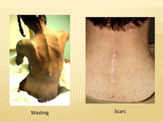 Wasting Scars
 