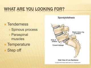 WHAT ARE YOU LOOKING FOR?
 Tenderness
 Spinous process
 Paraspinal
muscles
 Temperature
 Step off
 