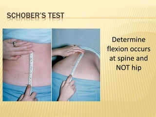 SCHOBER’S TEST
Determine
flexion occurs
at spine and
NOT hip
 