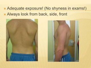  Adequate exposure! (No shyness in exams!)
 Always look from back, side, front
 