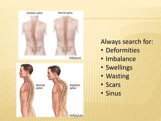 Always search for:
• Deformities
• Imbalance
• Swellings
• Wasting
• Scars
• Sinus
 