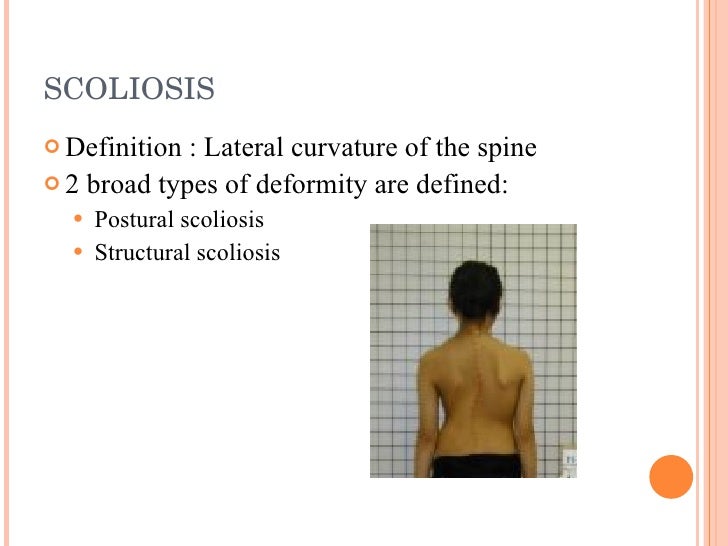 Spine Examination And Scoliosis