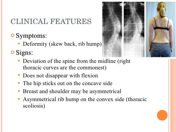 Spine Examination And Scoliosis