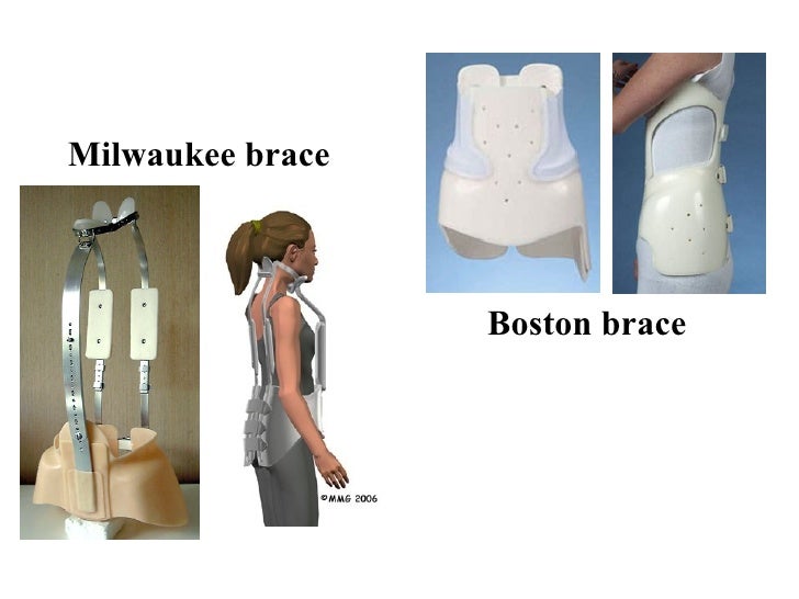 Spine Examination And Scoliosis