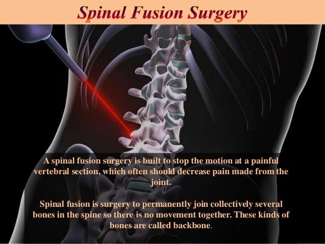 Low Cost Packages for Spinal Fusion Surgery in Fortis
