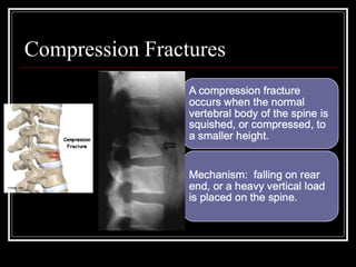 spine Injuries in sports, anatomy, epidemiology, and biomechanic.ppt