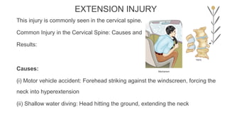 SPINE INJURY MECHANISM AND THEIR CLINICAL FEARURES | PPTX
