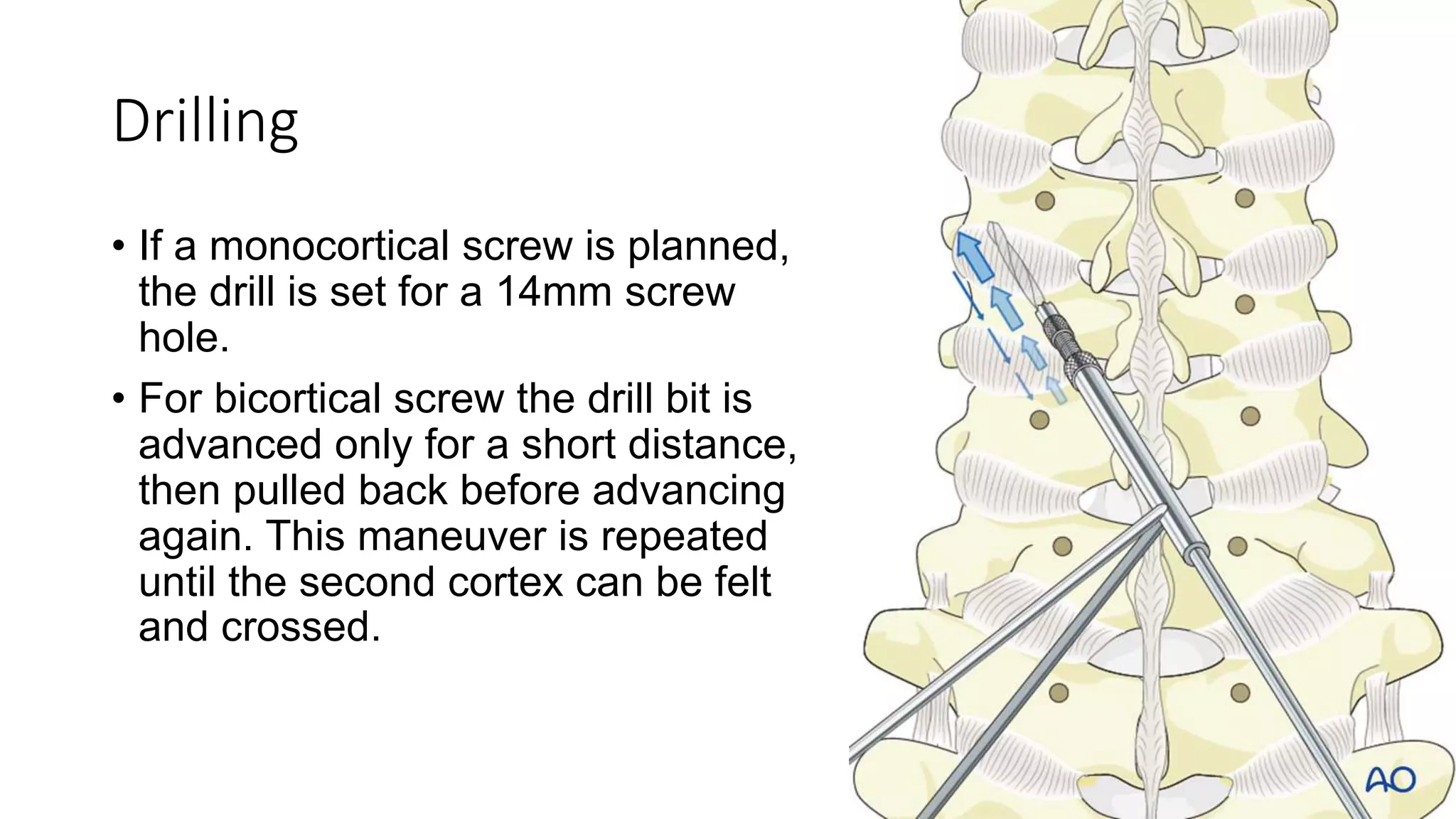 Spine Instrumentation.pptx