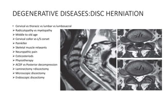 Spine lecture for Final year MBBS by Dr.Mumtaz Ali.pptx