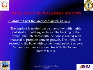 TOTAL FACET REPLACEMENT SYSTEMS
Anatomic Facet Replacement System (AFRS)
The implant is made from a super-alloy with highl...