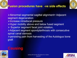 Fusion procedures have -ve side effects
➢Abnormal segmental sagittal alignment+ Adjacent
segment degeneration
➢Increase in...