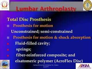 Total Disc Prosthesis
 Prosthesis for motion:
Unconstrained; semi-constrained
 Prosthesis for motion & shock absorption:...