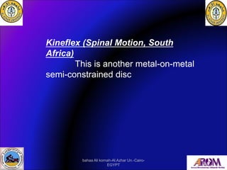 Kineflex (Spinal Motion, South
Africa)
This is another metal-on-metal
semi-constrained disc
bahaa Ali kornah-Al.Azhar Un.-...