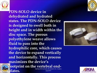 PDN-SOLO device in
dehydrated and hydrated
states. The PDN-SOLO device
is designed to swell both in
height and in width wi...