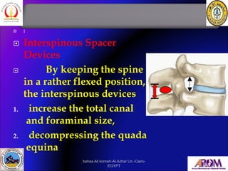  :
 Interspinous Spacer
Devices
 By keeping the spine
in a rather flexed position,
the interspinous devices
1. increase...