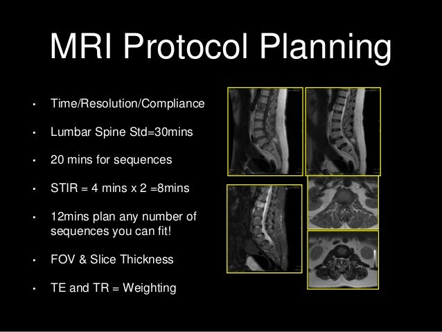 Spine Mri Bir 2 Copy Spine Mri Bir 2 Copy