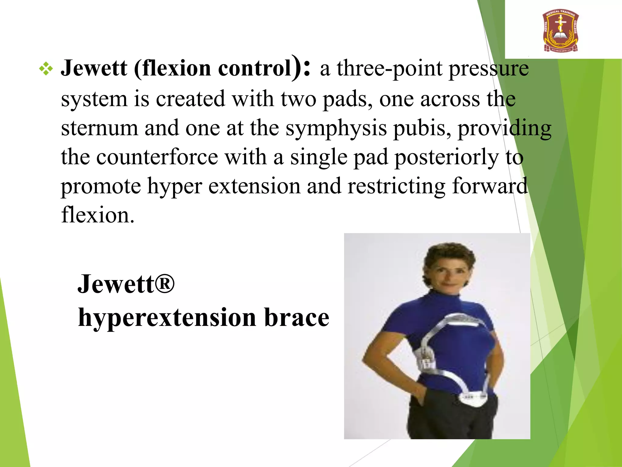  Jewett (flexion control): a three-point pressure
system is created with two pads, one across the
sternum and one at the symphysis pubis, providing
the counterforce with a single pad posteriorly to
promote hyper extension and restricting forward
flexion.
Jewett®
hyperextension brace
 