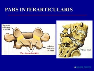 Part Interarticularis Spondylolysis and Sports Injury Treatment | PPT