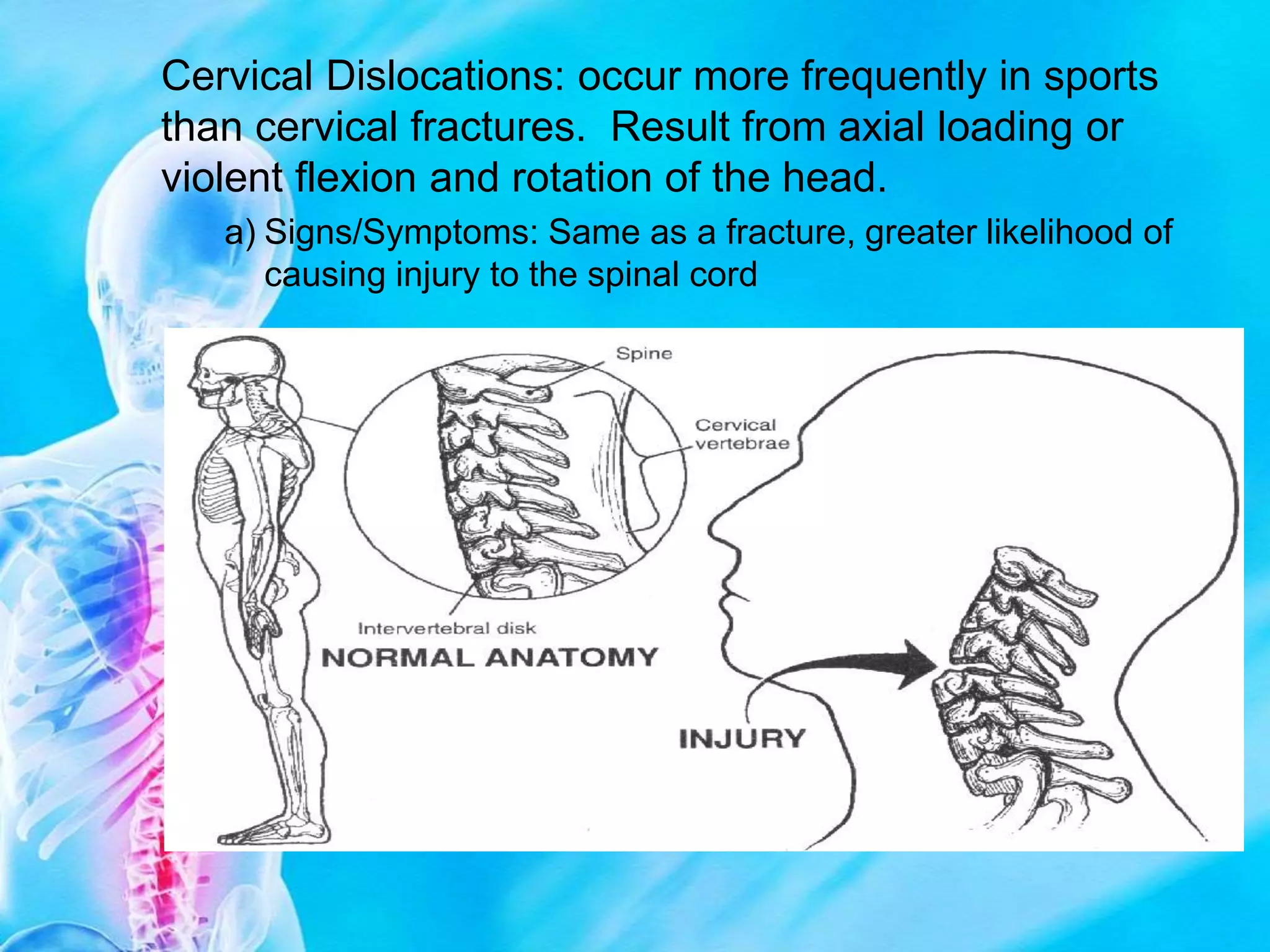Spine Powerpoint.ppt