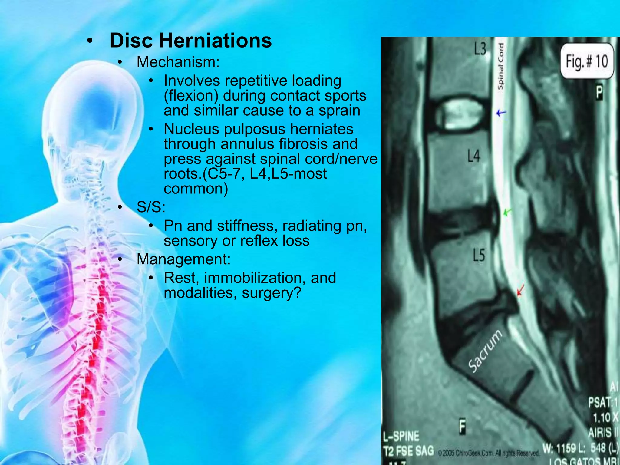 Spine Powerpoint.ppt
